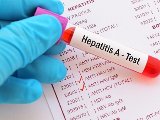 Alerta: Confirman 34 nuevos casos de hepatitis A en Argentina